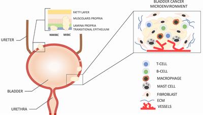 Editorial: Tumor microenvironment in bladder cancer